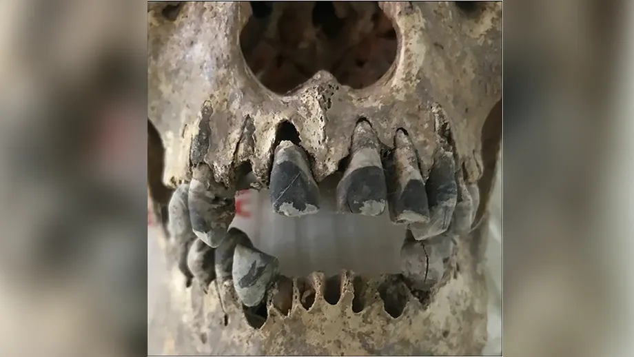 古代ベトナムの黒い歯：鉄器時代の共同体が築いた2,000年の美の基準